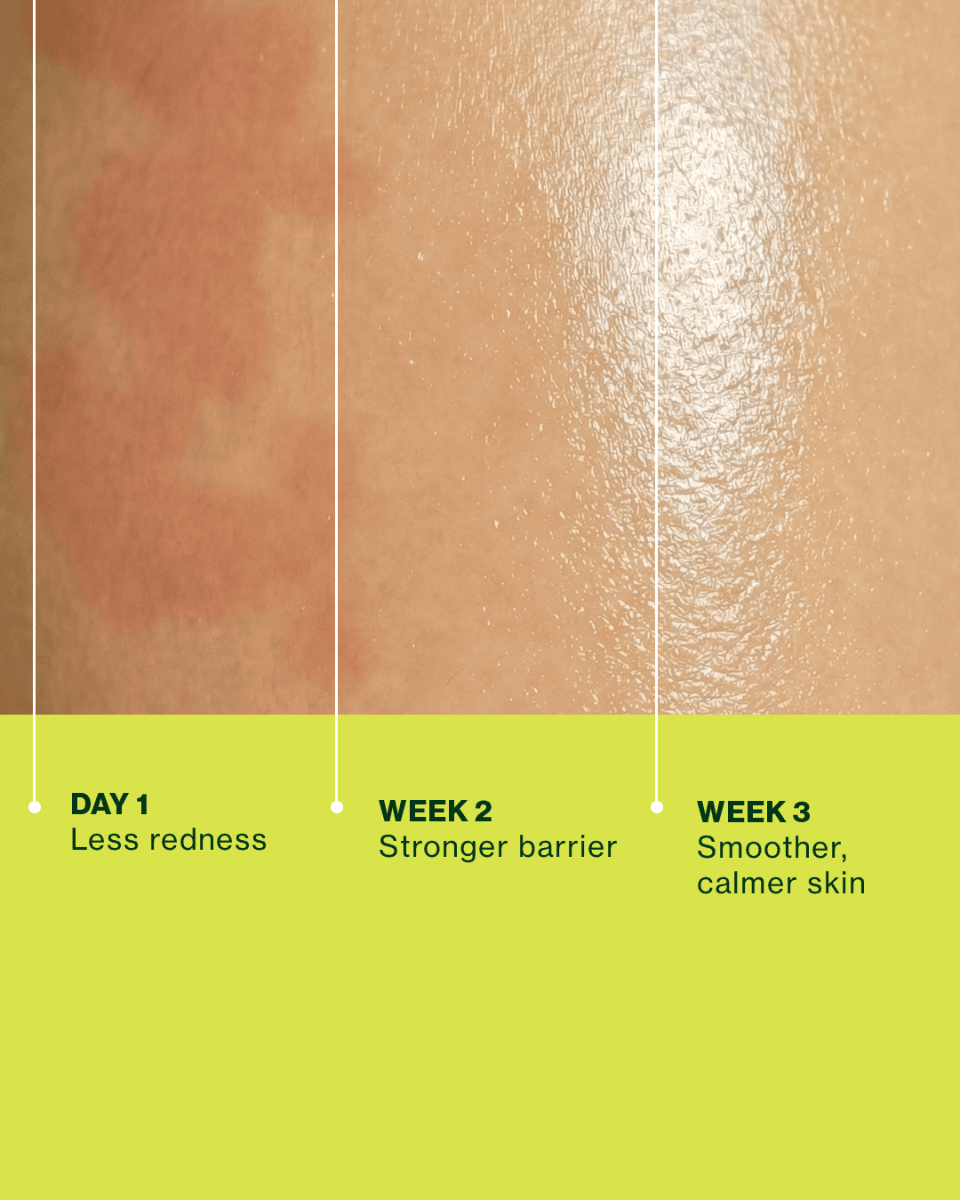 Skin Ceremony